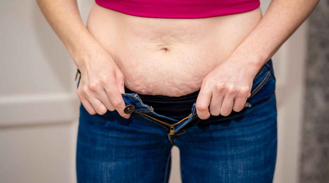  Woman with belly fat trying to zip pants